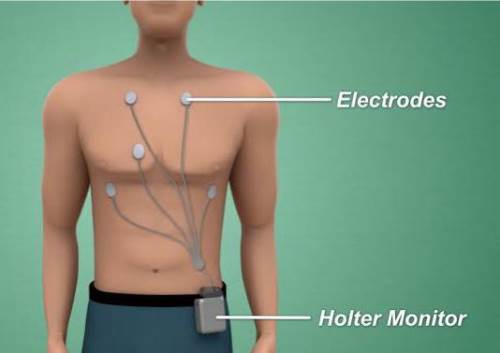 جهاز Holter